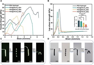 Antibacterial and anti-inflammatory polyethyleneimine/polyacrylic acid hydrogel loaded with CeO2 quantum dots for wet tissue wound dressings